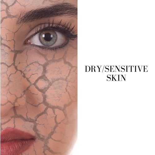 SENSITIVE SKIN